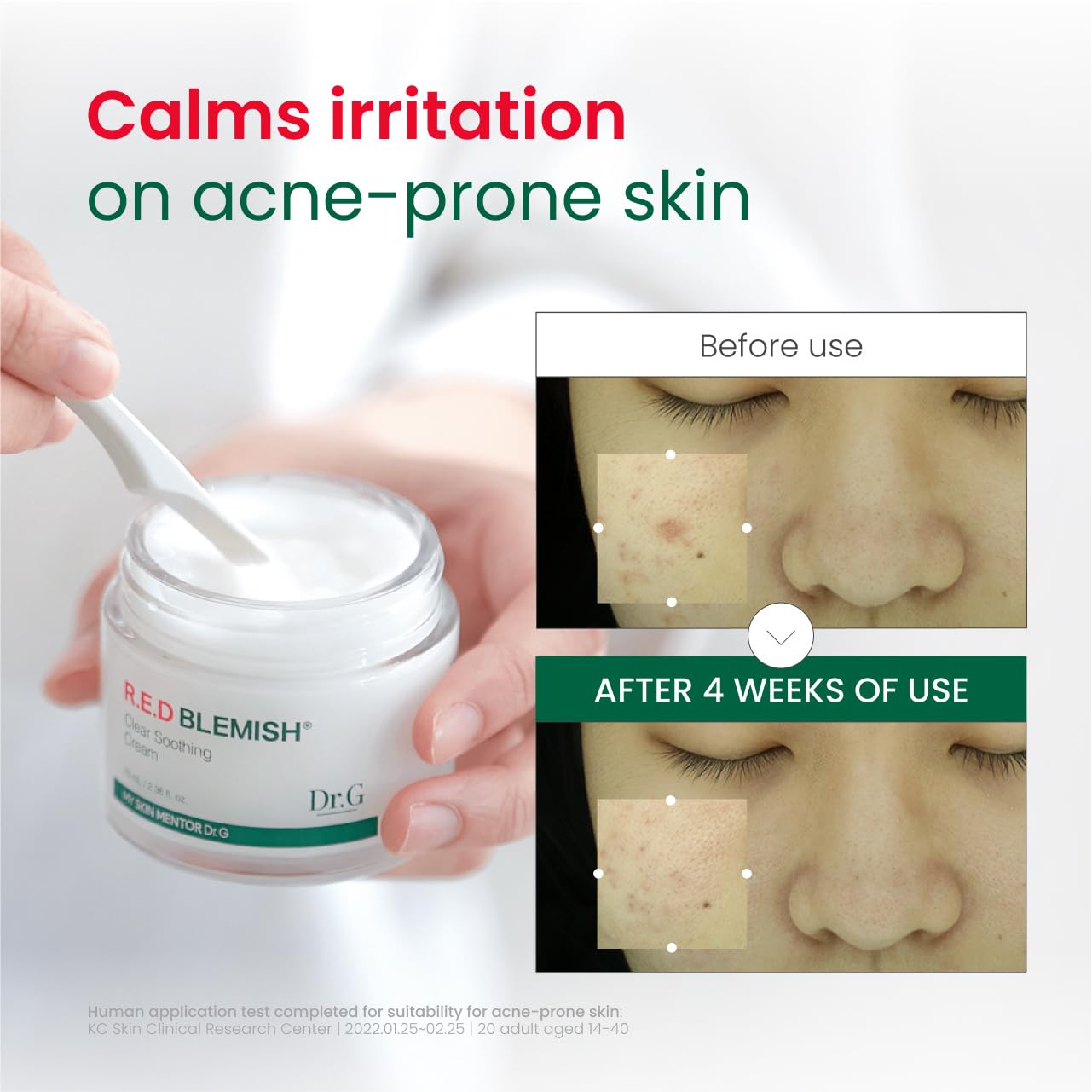 Red Blemish Clear Soothing Korean Moisturizer Face Cream, 70Ml - Cica Cream, Korean Skin Care Moisturizer, Korean Face Moisturizer, Facial Moisturizer, Korean Skincare, K Beauty Skincare Coreano