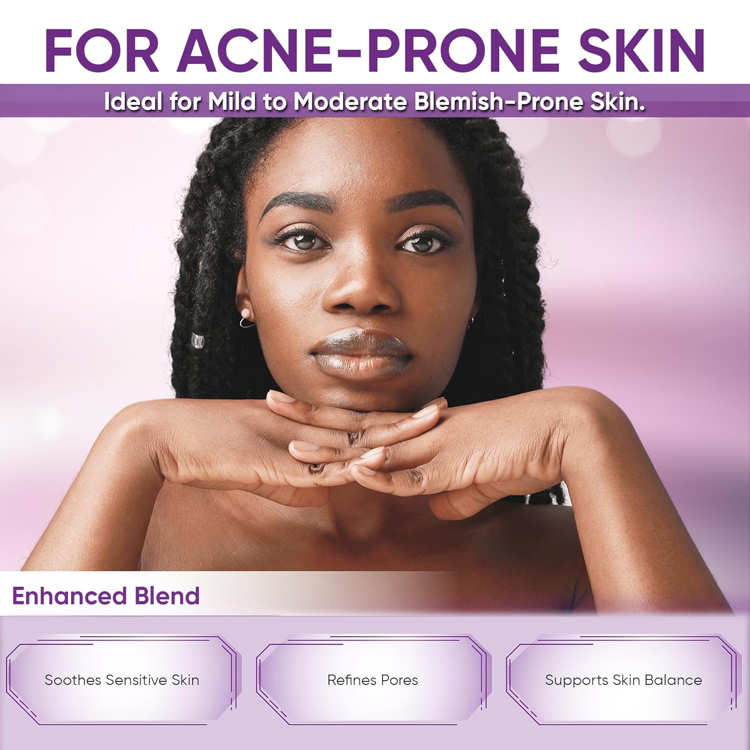 Azelaic Acid Acne Cream: Azelaic Acid for Face - Premium Azelaic Acid Cream - Face Skin and Beauty Care - Azelaic Acid Facial Cream, 1 Oz